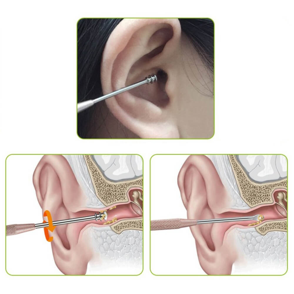 hilloo-cure-oreille-inox-argent-double-embout-r-utilisable image 3